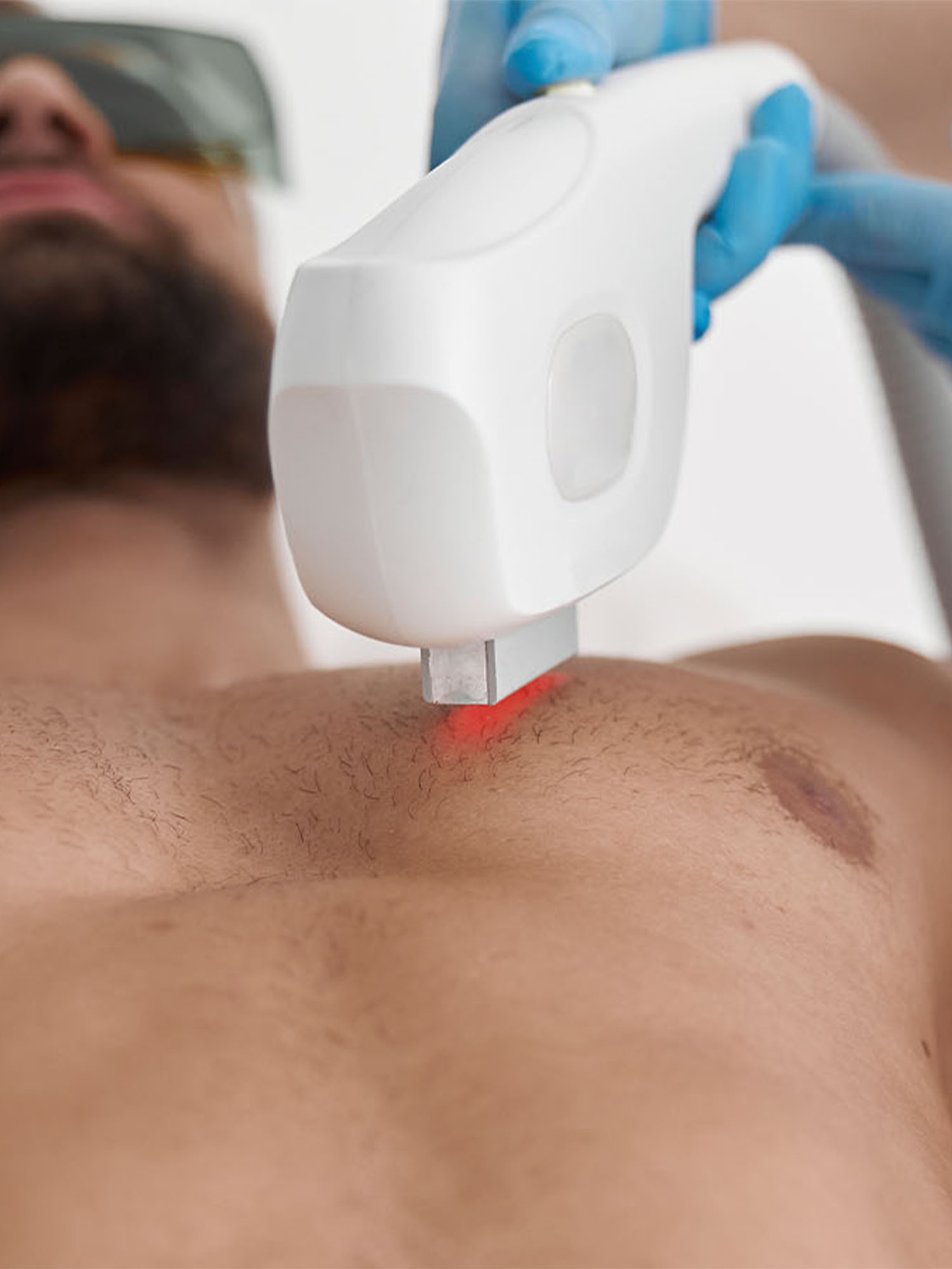 Hair Removal for men at Men's Bodyland