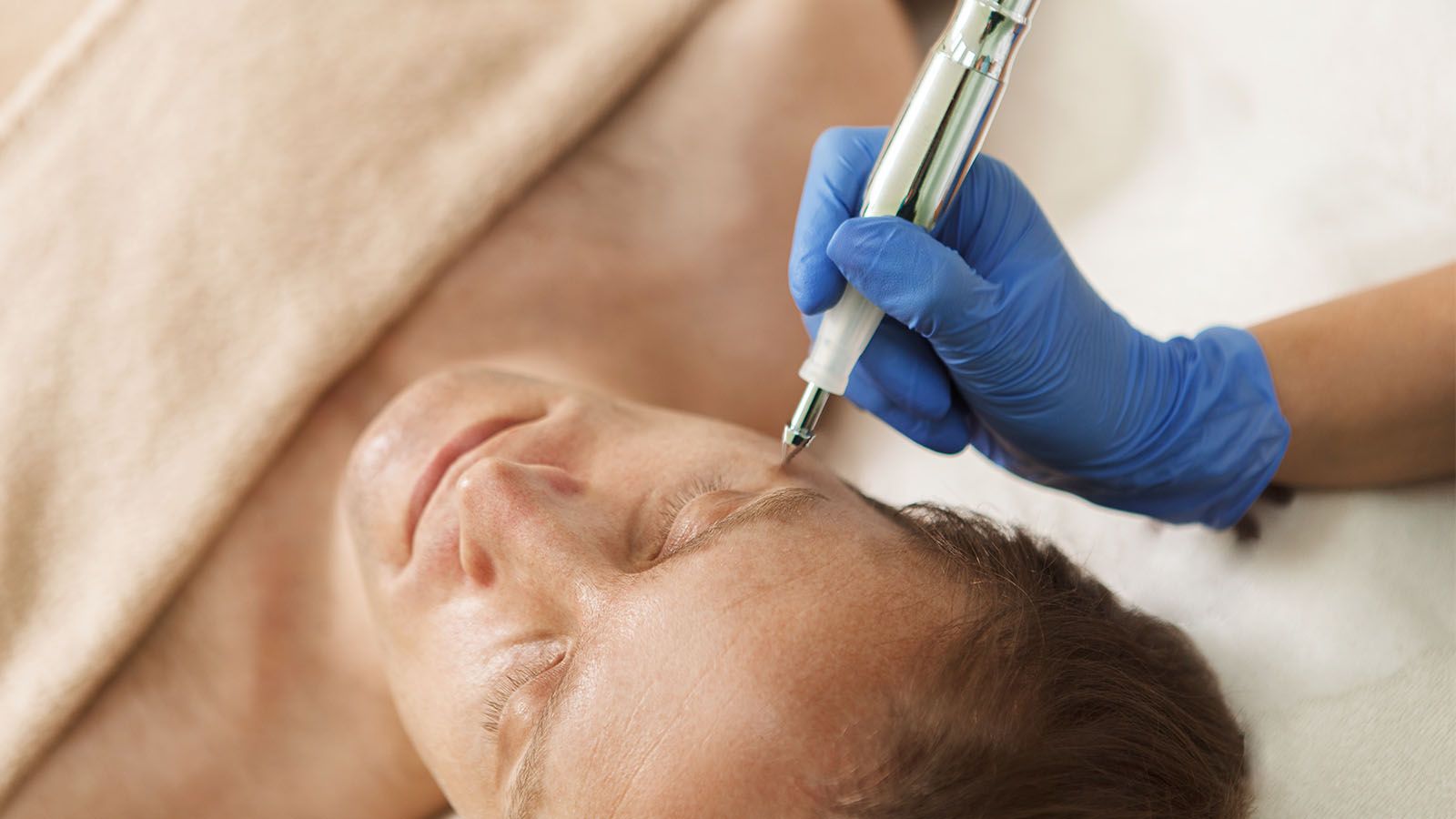 Coagulatie gezichtsbehandeling voor mannen bij Bodyland