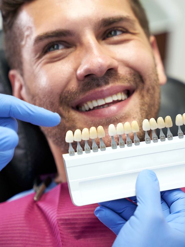 Men&rsquo;s Bodyland Tanden Bleken